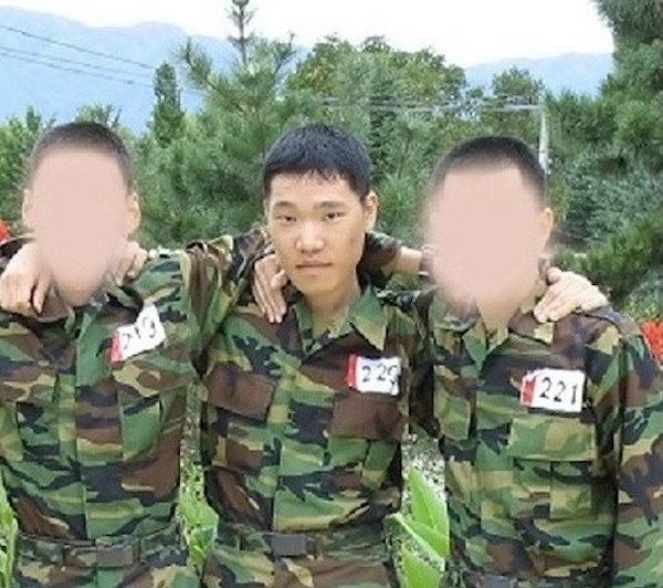 Korean boy before and after surgery