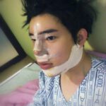 korean-boy-before-and-after-surgery-2.jpg