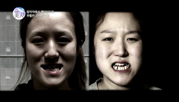 Korean Sisters with Plastic Surgery