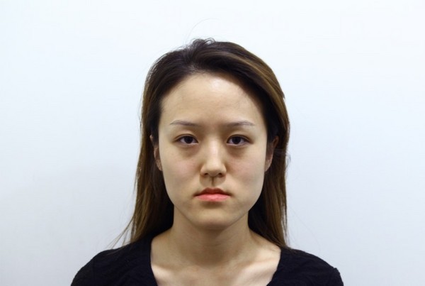 Korean Sisters with Plastic Surgery