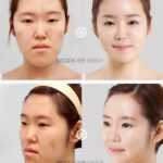plastic-surgery-in-korea-1.jpg