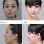 plastic-surgery-in-korea-10.jpg