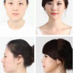 plastic-surgery-in-korea-2.jpg