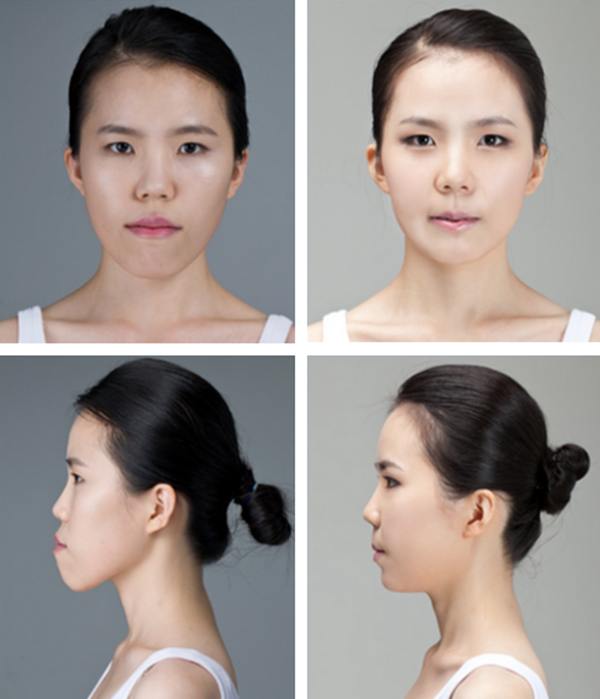 Plastic surgery in korea
