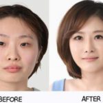 plastic-surgery-in-korea-6.jpg