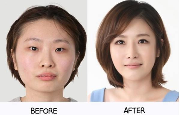 Plastic surgery in korea