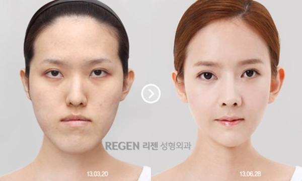 plastic-surgery-in-korea-7.jpg