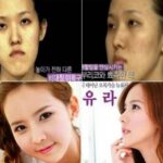 plastic-surgery-in-korea-8.jpg