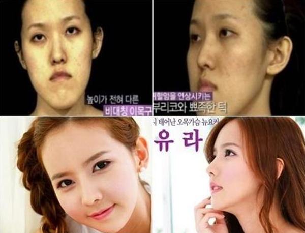 plastic-surgery-in-korea-8.jpg